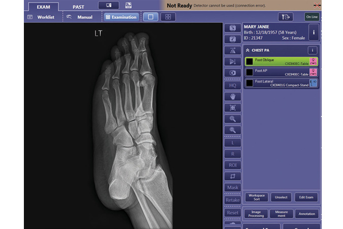 Xray images on the Control Software NE