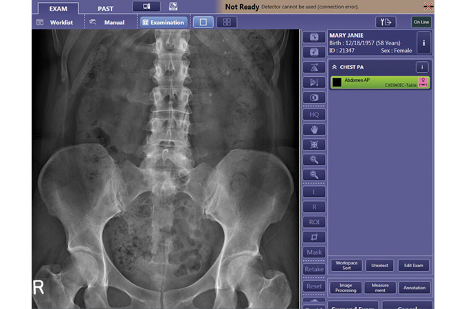 Xray images on the Control Software NE