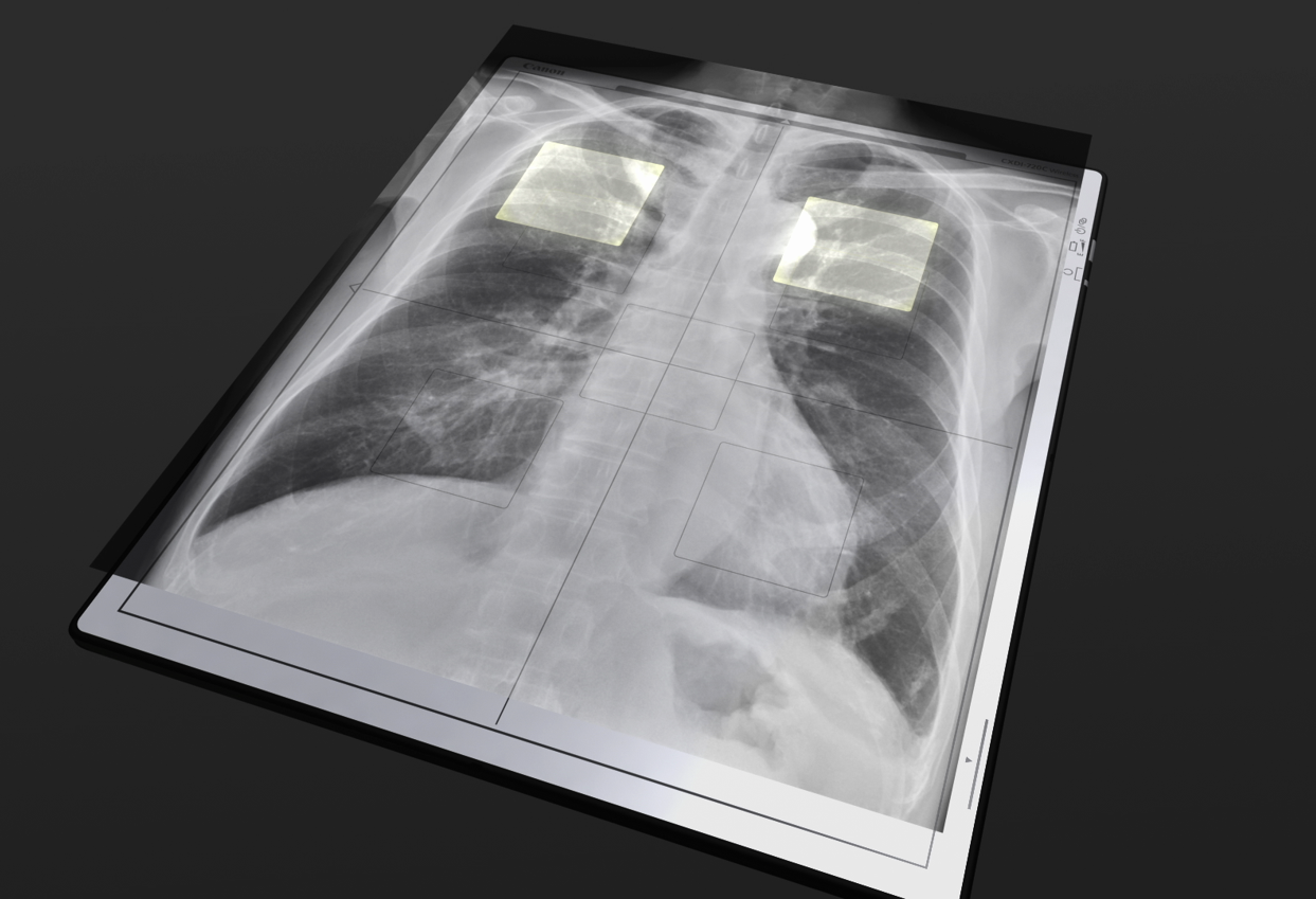 CXDI-Elite Product image