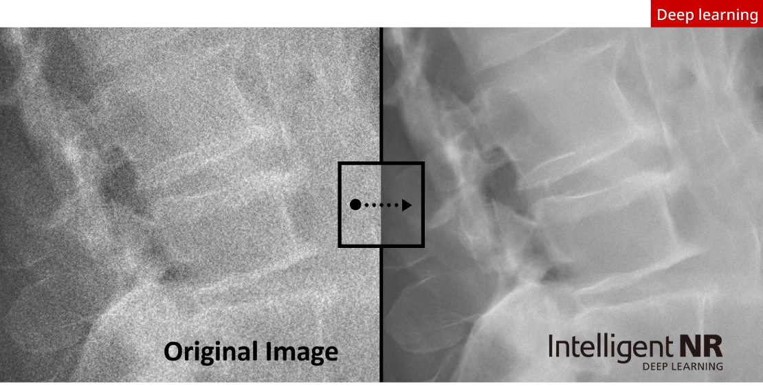 Intelligent Noise Redction get image much clear and details are much easy to see.